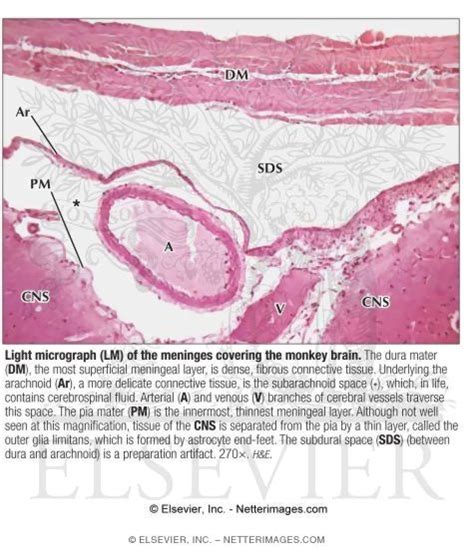 Arachnoid Histology