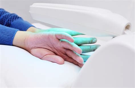 Phototherapy for Eczema: How UV Light Therapy Can Help