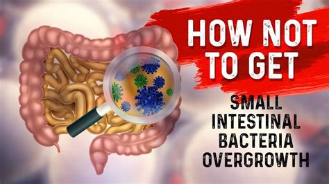 How to STOP Small Intestine Bacterial Overgrowth(SIBO)? – Dr. Berg ...