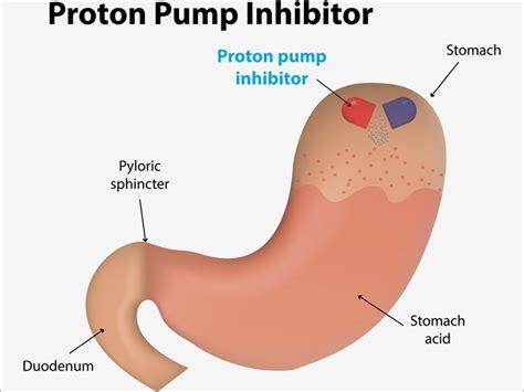 Proton pump inhibitors