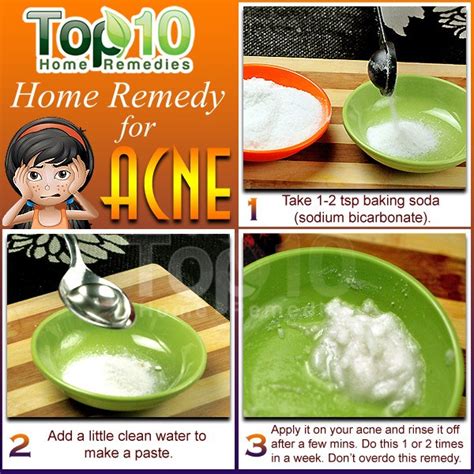 Home Remedies for Acne | Top 10 Home Remedies