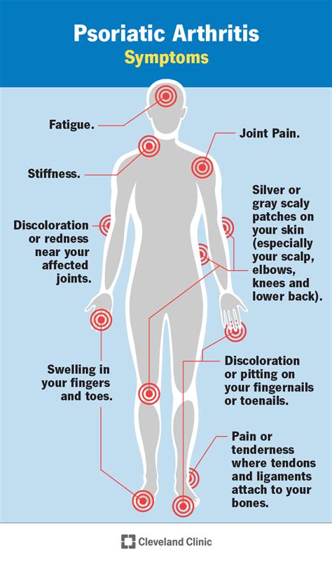 Psoriatic Arthritis: Symptoms and Treatments