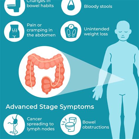 Colorectal Cancer Signs And Symptoms