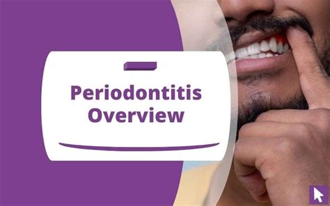 Periodontitis Overview: Symptoms, Causes, and Treatments