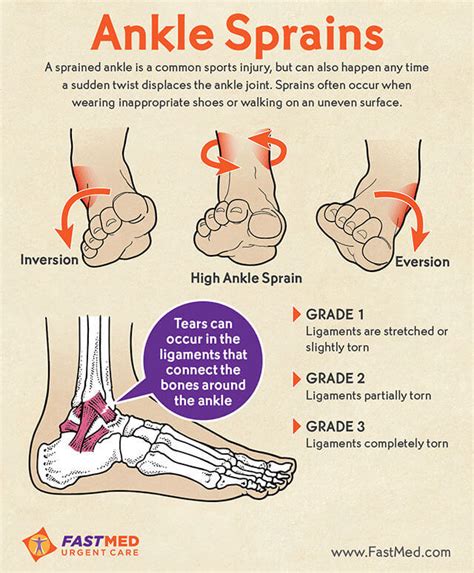 Ankle Sprain Grades 1