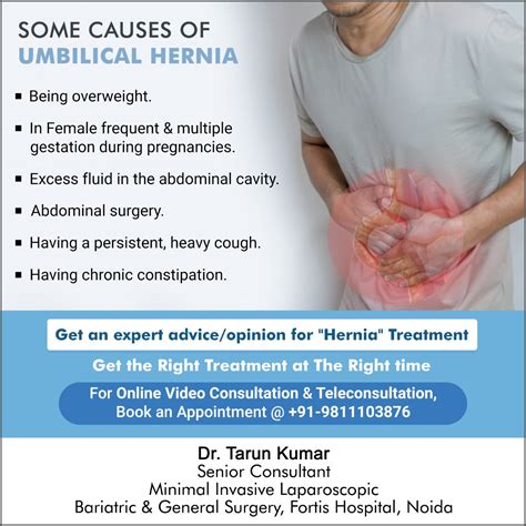 Dr. Tarun Kumar Surgeon: Some Causes of Umbilical Hernia