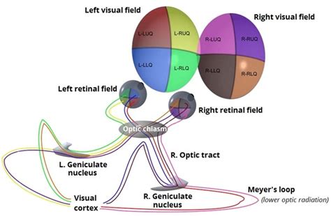 Visual Pathway and Visual Field Defects | Geeky Medics