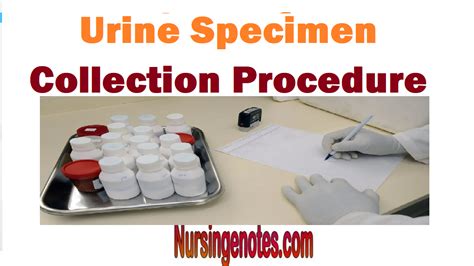 Urine Specimen Collection Procedure - Male, female and infants - NursingNotes