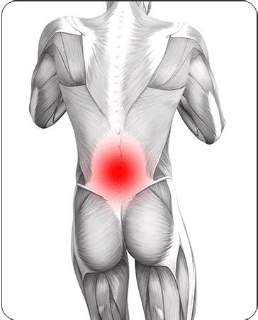 Lower Back Muscle Strain | Symptoms, Causes and Treatment