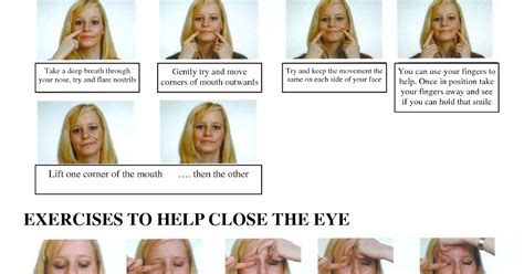 Facial Exercises For Bells Palsy Pictures - Exercise Poster