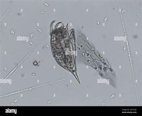 Freshwater aquatic zooplankton and algae under microscope view Stock ...