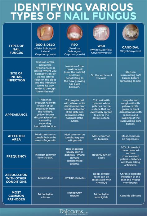 Toenail Fungus: Symptoms, Causes and Support Strategies