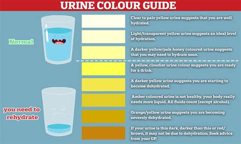 Is Dark Yellow Urine Bad? Understanding The Significance Of Urine Color