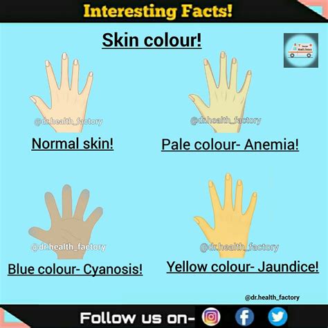 Anemia Skin Color