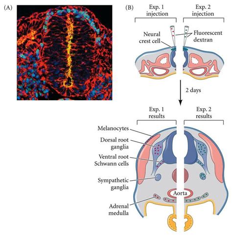 44 best Neural crest derivatives images on Pinterest | Anatomy ...