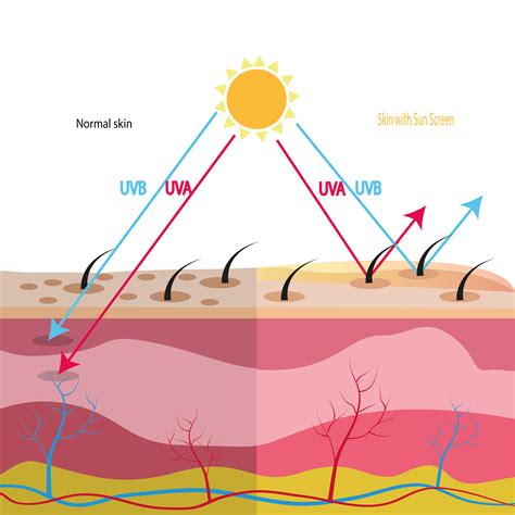 Skin Damage From Sun Exposure – South East Dermatology