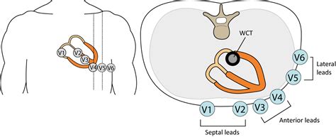 The ECG leads: electrodes, limb leads, chest (precordial) leads, 12 ...