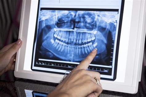 dental x-rays Panoramic x-ray | Hancock Village Dental | Dentist Clermont Florida