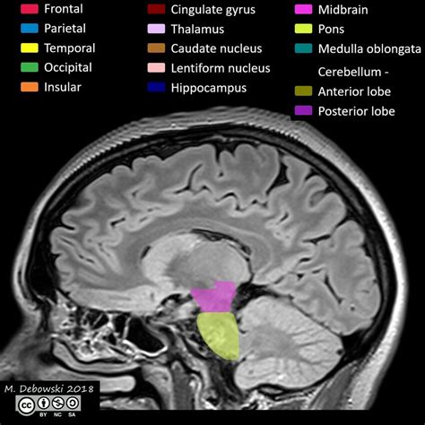 Brain lobes - annotated MRI (Radiopaedia 61691-69700 Sagittal) - NC Commons