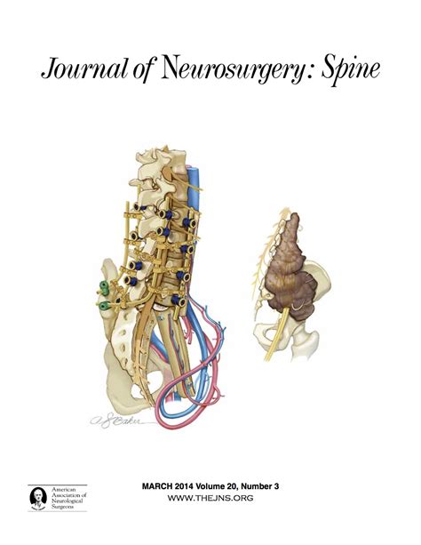 Pedicle Anatomy - Anatomical Charts & Posters