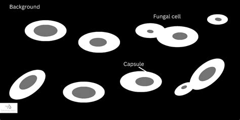 Negative staining procedure, principle, and results