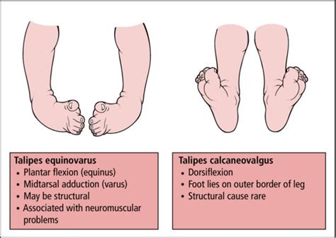 Bones and joints | Obgyn Key