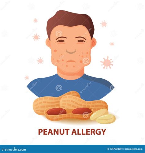 Nut Allergy Symptoms Problem .Swollen Man Character.Anaphylaxis Person Concept. Stock Vector ...