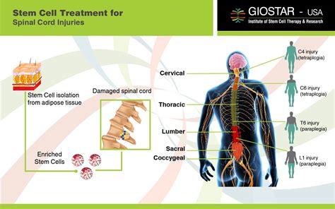 Spinal Cord Injury Symptoms Diagnosis And Treatment | Hot Sex Picture