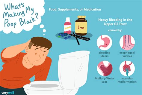 Black Stool: What Causes It and When to Visit the Doctor