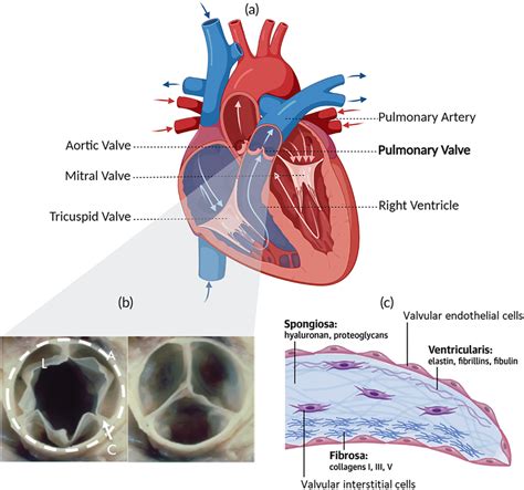 Pulmonary Valve Location