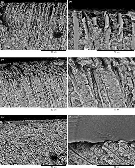 SEM micrographs of dentinal tubules treated with (a, b) the BCCS-P2.0;... | Download Scientific ...