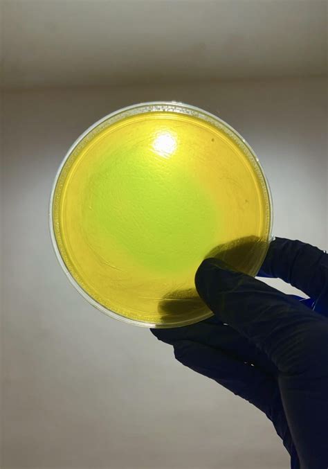 Multicoloured Agar Plates 🧫 : r/Agarporn