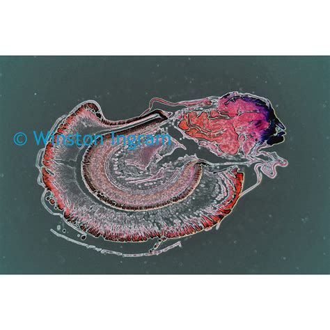 Microscopy Insects | Microbus Microscope Educational Website