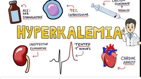 Hyperkalemia Symptoms Ekg