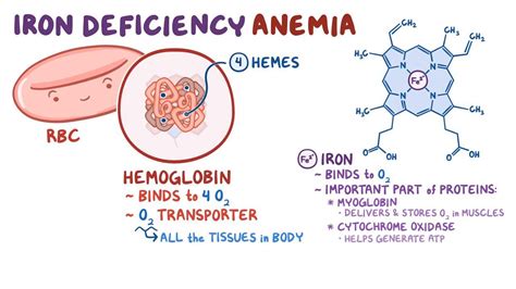 Iron deficiency anemia: Video, Anatomy & Definition | Osmosis