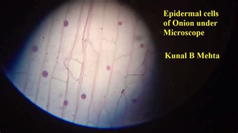 Onion Epidermal Cells Under Microscope