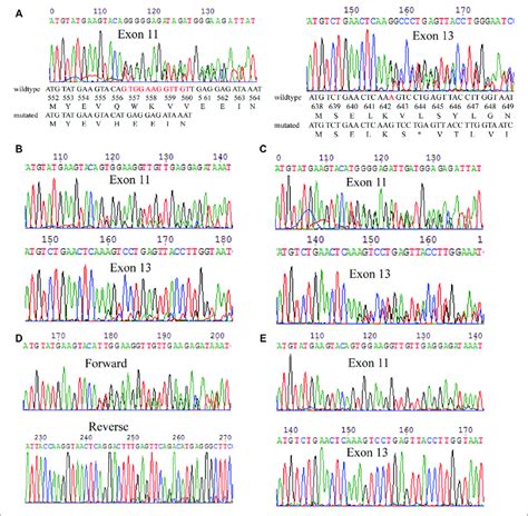 | Mutation analysis of the c-KIT gene in different specimens. (A ...