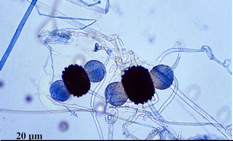 Zygospore Fungi Examples