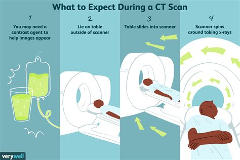 Parts Of Ct Scan