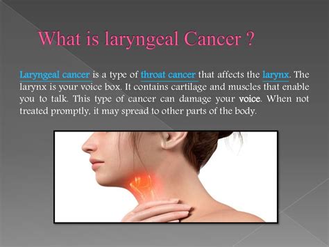 Signs, Symptoms and Treatment of Laryngeal Cancers