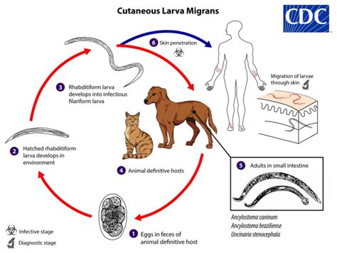 Cutaneous larva migrans causes, symptoms, diagnosis, treatment & prognosis