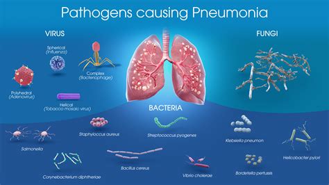 Pneumonia - Scientific Animations