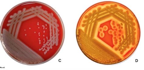 Agar Plates – The Microbial Menagerie