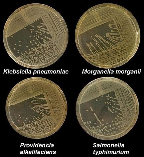 Nutrient Agar: Composition, Preparation and Uses