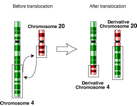 Chromosomal translocation - Wikipedia