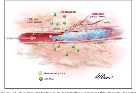 Figure 4 from New High Dose Pulsed Hyaluronidase Protocol for Hyaluronic Acid Filler Vascular ...