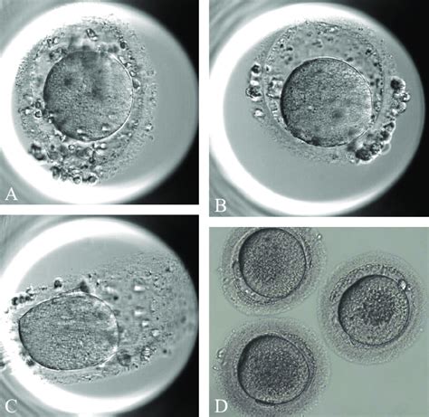 -Oocyte dysmorphism: a) debris in the perivitelline space; B) enlarged... | Download Scientific ...