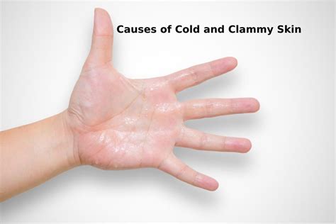 Causes of Cold and Clammy Skin