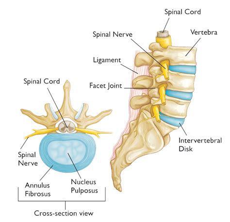 How to tell if you have a Herniated Disk - Orthopedic & Sports Medicine