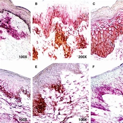 HLA-DR and intercellular adhesion molecule (ICAM)-1 expression in... | Download Scientific Diagram